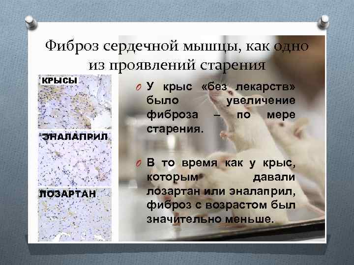 Фиброз сердечной мышцы, как одно из проявлений старения O У крыс «без лекарств» было