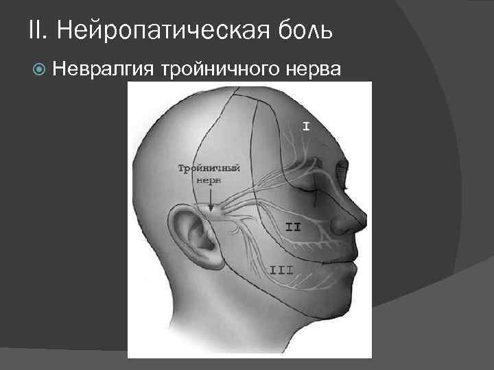 II. Нейропатическая боль Невралгия тройничного нерва 