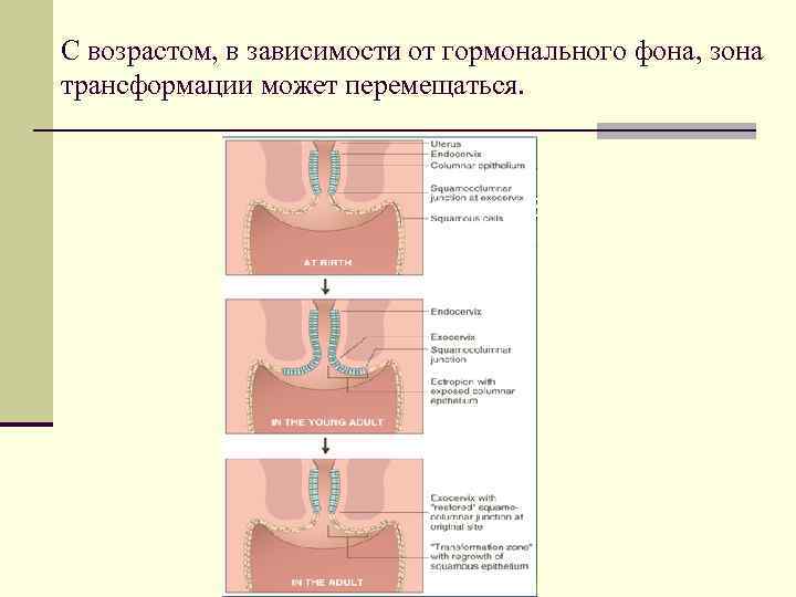 Трансформация 3 типа