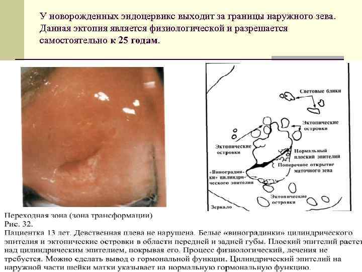 Патология шейки матки презентация