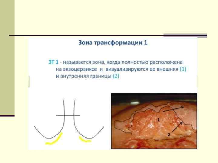 Патология шейки матки презентация