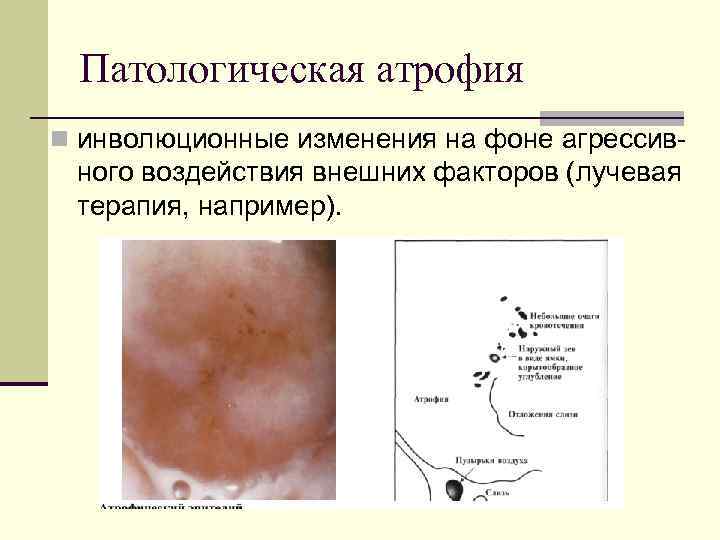 Патология шейки матки презентация