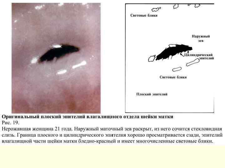 Патология шейки матки презентация