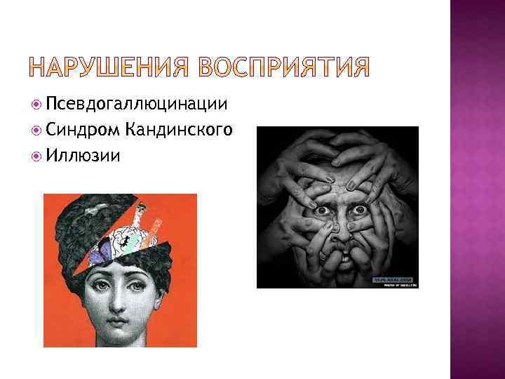  Псевдогаллюцинации Синдром Иллюзии Кандинского 
