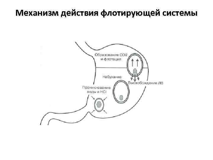 Механизм действия флотирующей системы 