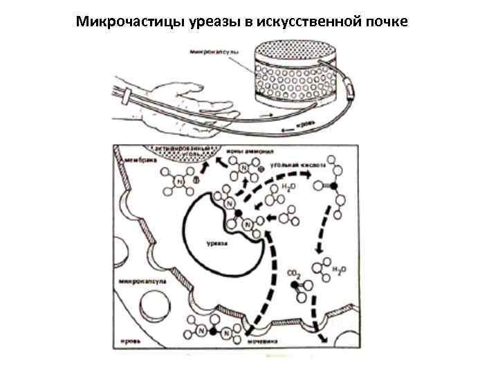 Микрочастицы уреазы в искусственной почке 
