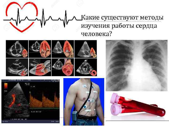 Обследование сердца какие бывают