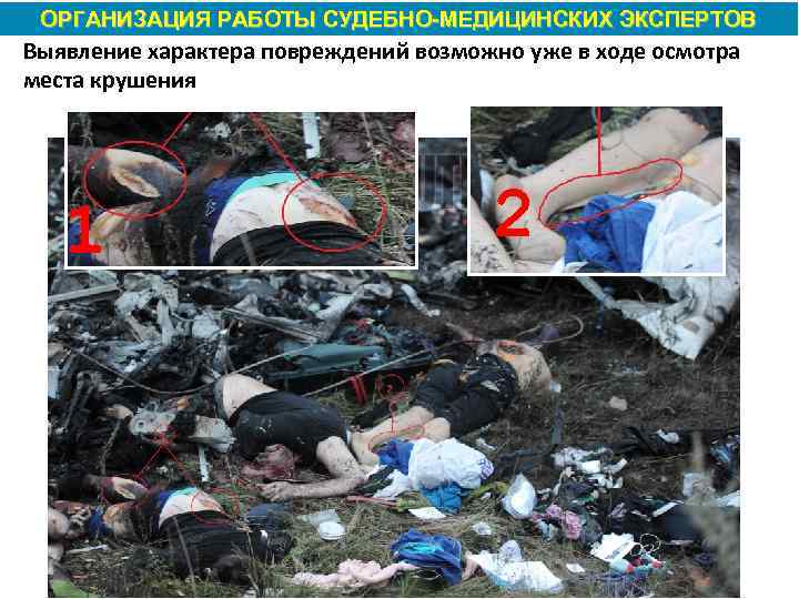 ОРГАНИЗАЦИЯ РАБОТЫ СУДЕБНО МЕДИЦИНСКИХ ЭКСПЕРТОВ Выявление характера повреждений возможно уже в ходе осмотра места