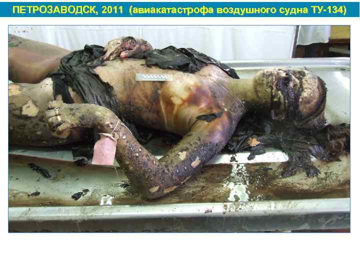 ПЕТРОЗАВОДСК, 2011 (авиакатастрофа воздушного судна ТУ 134) 