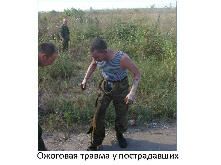 Ожоговая травма у пострадавших 