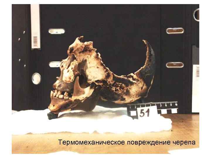 Термомеханическое повреждение черепа 