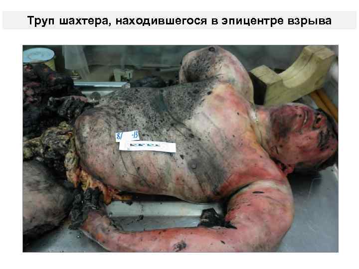 Труп шахтера, находившегося в эпицентре взрыва 