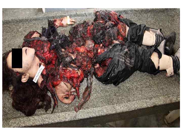 ТРУП СМЕРТНИЦЫ 