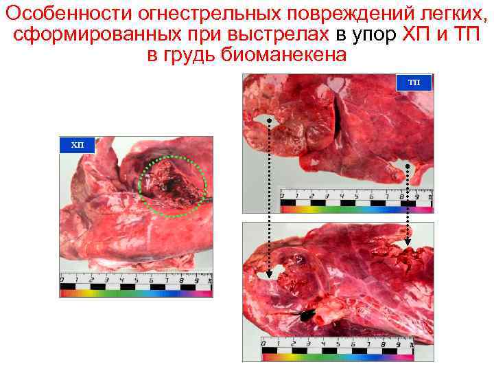 Особенности огнестрельных повреждений легких, сформированных при выстрелах в упор ХП и ТП в грудь