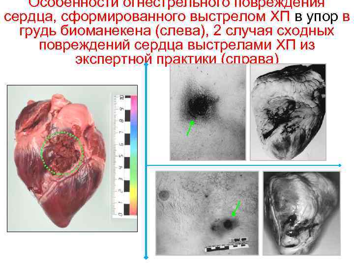 Особенности огнестрельного повреждения сердца, сформированного выстрелом ХП в упор в грудь биоманекена (слева), 2