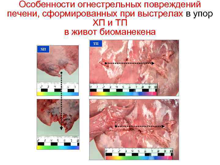 Особенности огнестрельных повреждений печени, сформированных при выстрелах в упор ХП и ТП в живот