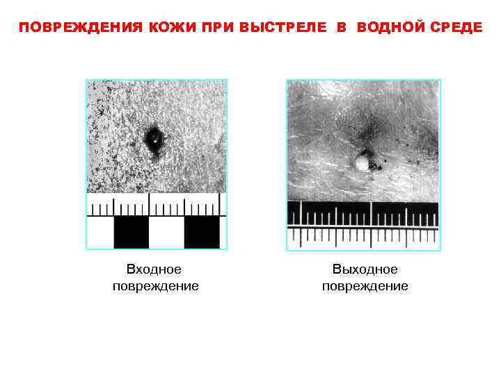 Тест судебно медицинская экспертиза