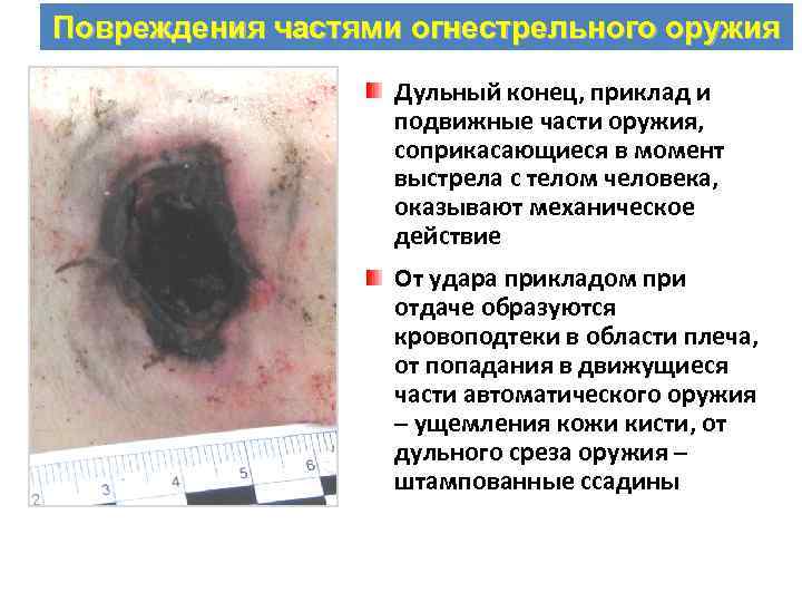 Повреждения частями огнестрельного оружия Дульный конец, приклад и подвижные части оружия, соприкасающиеся в момент