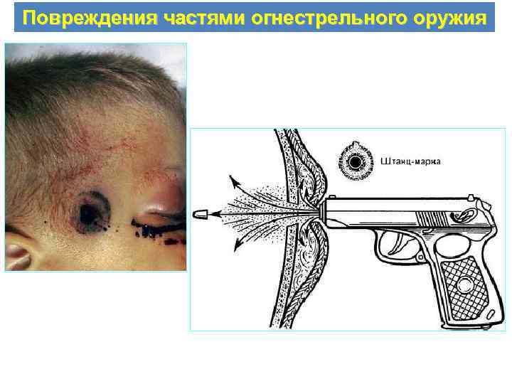 Огнестрельное ранение фото