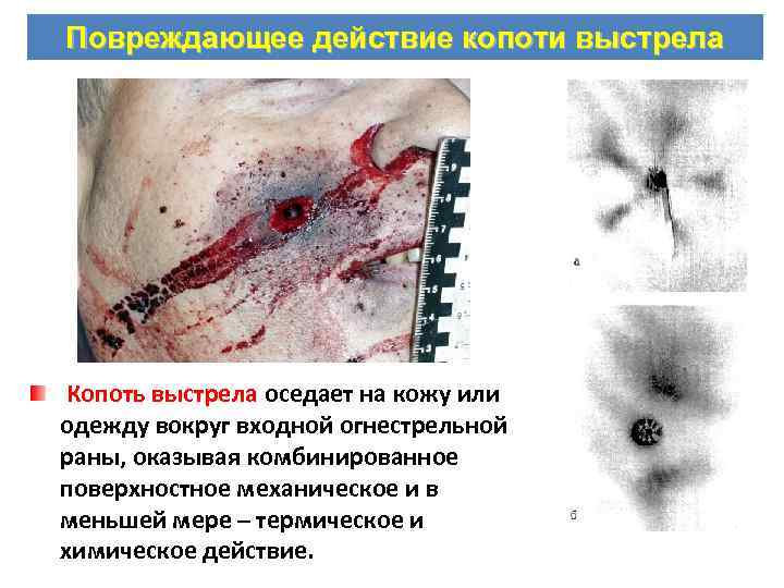 Повреждающее действие копоти выстрела Копоть выстрела оседает на кожу или одежду вокруг входной огнестрельной
