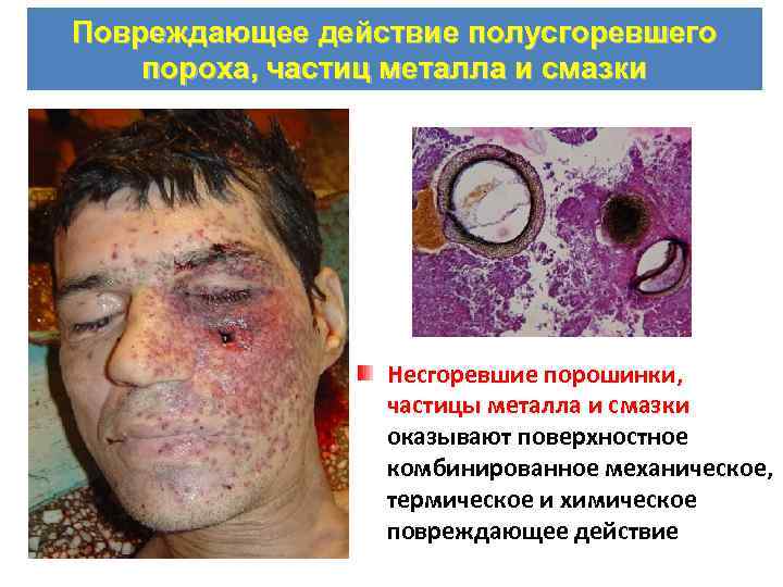 Повреждающее действие полусгоревшего пороха, частиц металла и смазки Несгоревшие порошинки, частицы металла и смазки