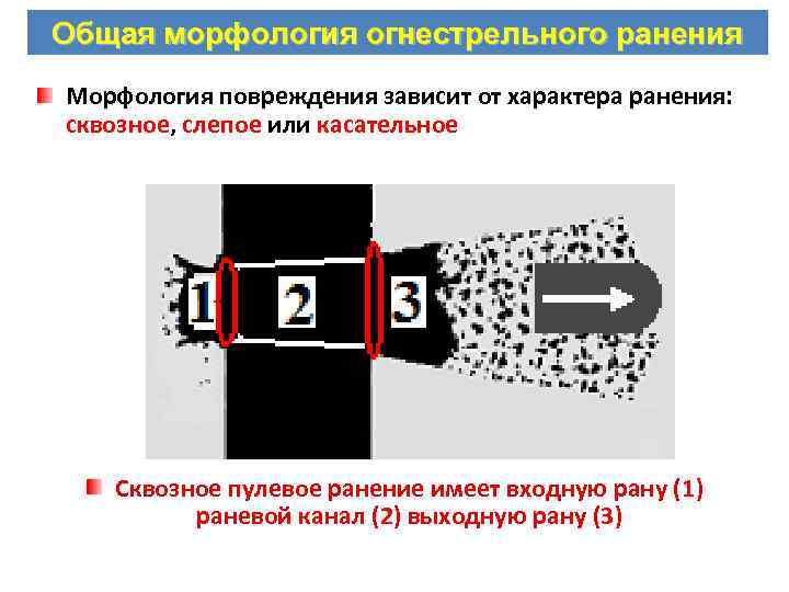 Код мкб огнестрельное ранение