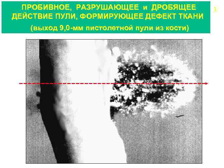 ПРОБИВНОЕ, РАЗРУШАЮЩЕЕ и ДРОБЯЩЕЕ ДЕЙСТВИЕ ПУЛИ, ФОРМИРУЮЩЕЕ ДЕФЕКТ ТКАНИ (выход 9, 0 -мм пистолетной