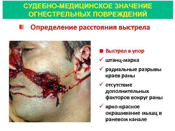СУДЕБНО-МЕДИЦИНСКОЕ ЗНАЧЕНИЕ ОГНЕСТРЕЛЬНЫХ ПОВРЕЖДЕНИЙ Определение расстояния выстрела Выстрел в упор ü штанц-марка ü радиальные