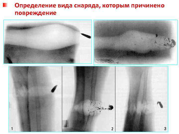 Определение вида снаряда, которым причинено повреждение 