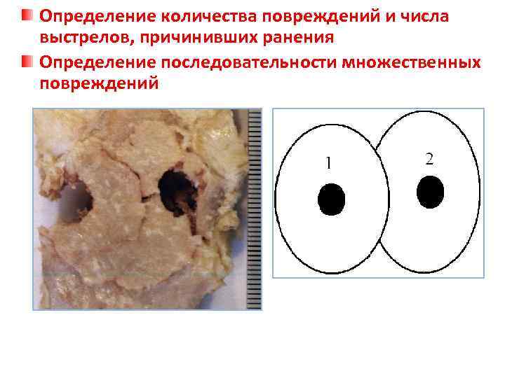 Определение количества повреждений и числа выстрелов, причинивших ранения Определение последовательности множественных повреждений 