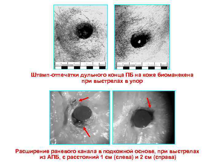 Штамп-отпечатки дульного конца ПБ на коже биоманекена при выстрелах в упор Расширение раневого канала