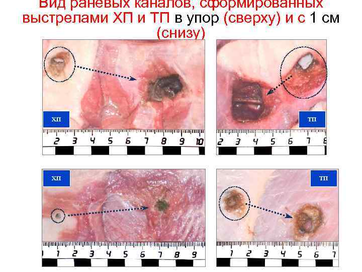 Вид раневых каналов, сформированных выстрелами ХП и ТП в упор (сверху) и с 1