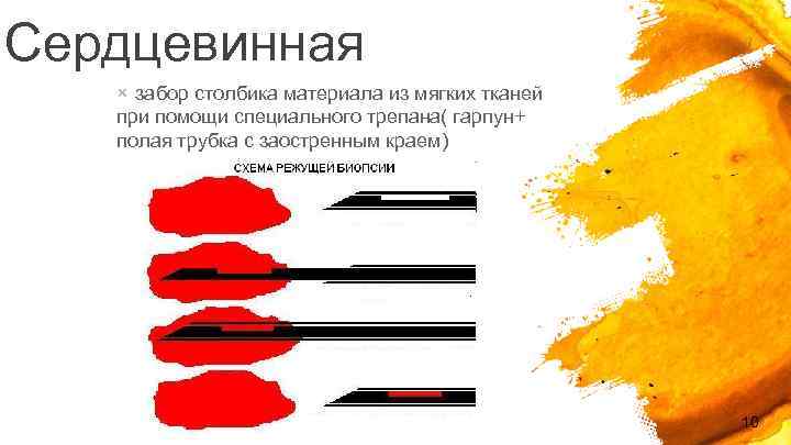 Сердцевинная × забор столбика материала из мягких тканей при помощи специального трепана( гарпун+ полая