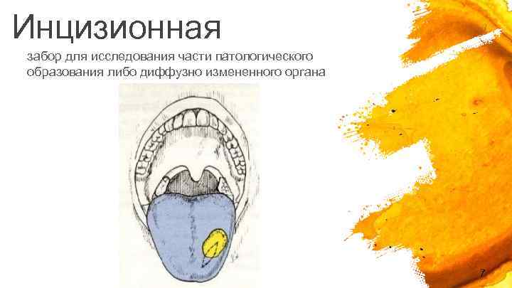 Инцизионная забор для исследования части патологического образования либо диффузно измененного органа 7 