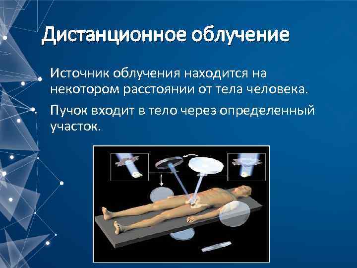 Дистанционное облучение Источник облучения находится на некотором расстоянии от тела человека. Пучок входит в