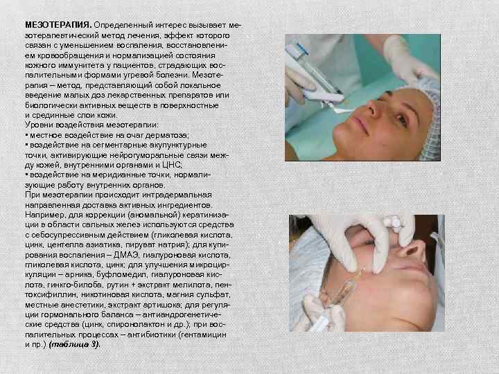 МЕЗОТЕРАПИЯ. Определенный интерес вызывает мезотерапевтический метод лечения, эффект которого связан с уменьшением воспаления, восстановлением