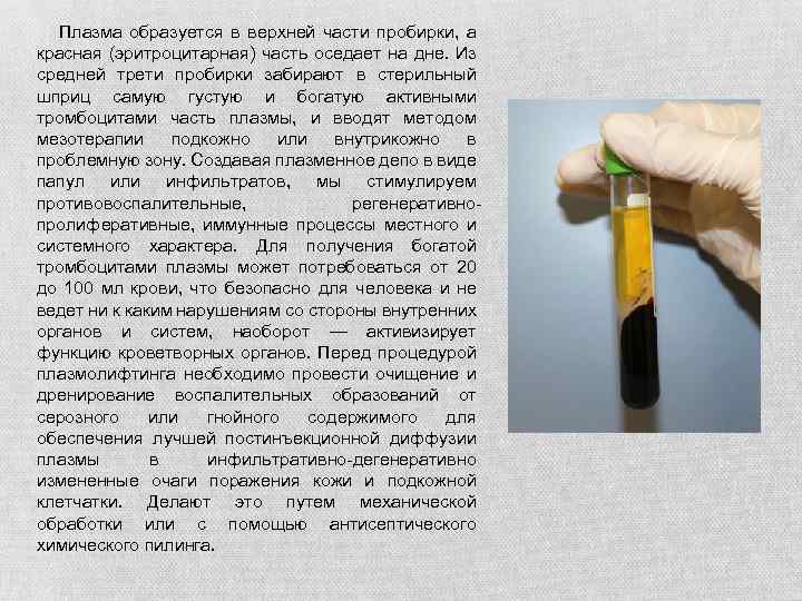  Плазма образуется в верхней части пробирки, а красная (эритроцитарная) часть оседает на дне.