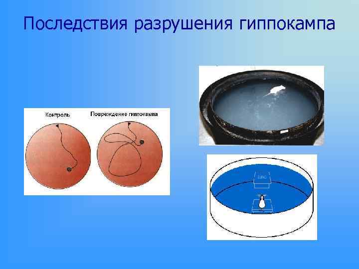 Последствия разрушения гиппокампа 