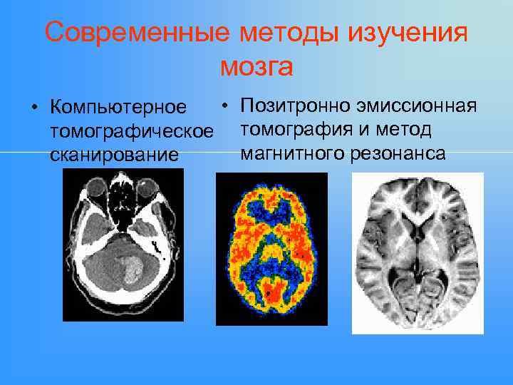 Современные методы изучения мозга • Позитронно эмиссионная • Компьютерное томографическое томография и метод магнитного