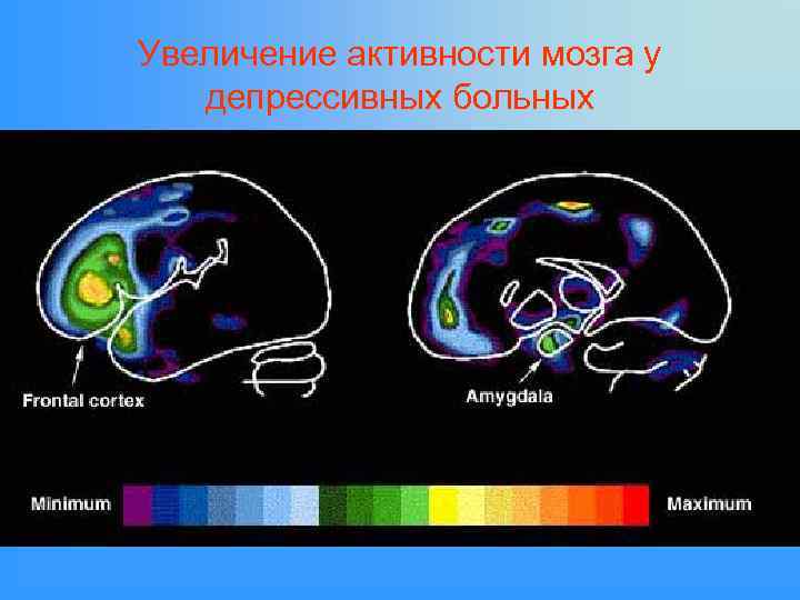 Увеличение активности мозга у депрессивных больных 