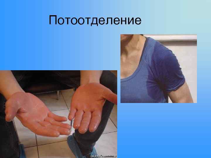 Потоотделение 