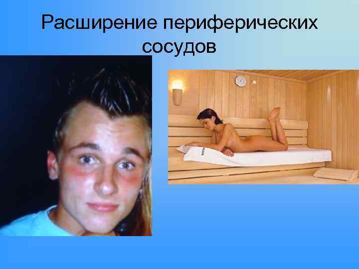 Расширение периферических сосудов 