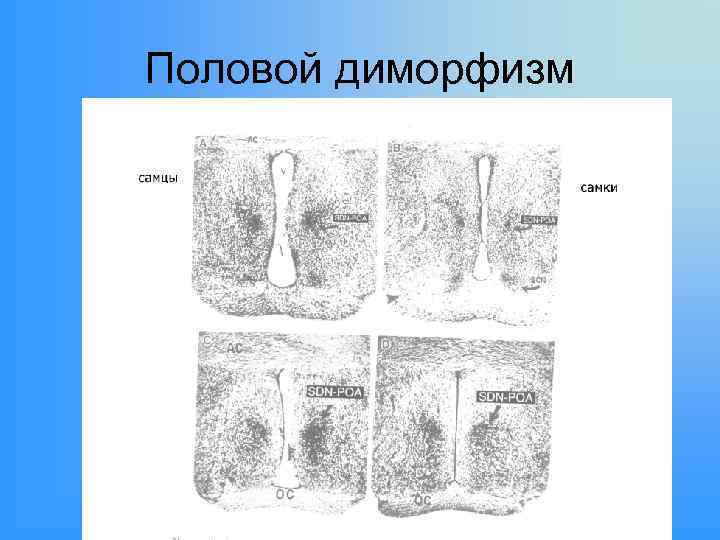 Половой диморфизм 