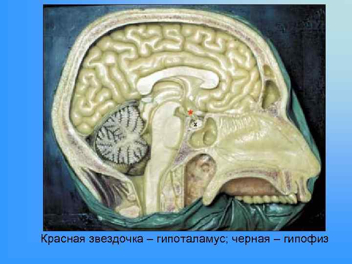 Красная звездочка – гипоталамус; черная – гипофиз 