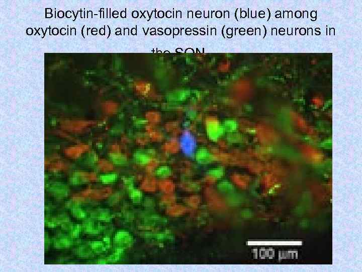 Biocytin-filled oxytocin neuron (blue) among oxytocin (red) and vasopressin (green) neurons in the SON.