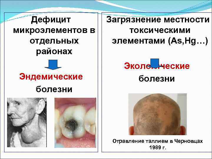 Дефицит микроэлементов в отдельных районах Эндемические болезни Загрязнение местности токсическими элементами (Аs, Hg…) Экологические