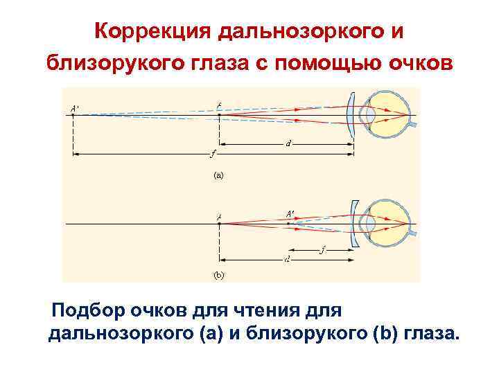 Коррекция дальнозоркого и близорукого глаза с помощью очков Подбор очков для чтения для дальнозоркого