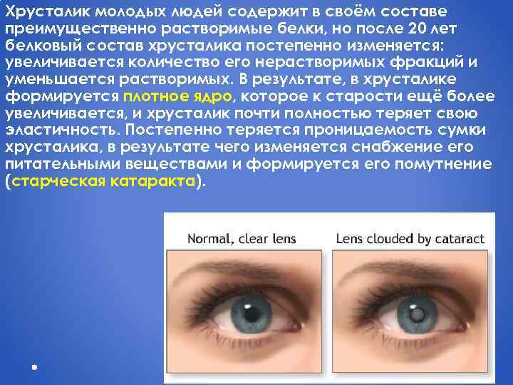Хрусталик молодых людей содержит в своём составе преимущественно растворимые белки, но после 20 лет