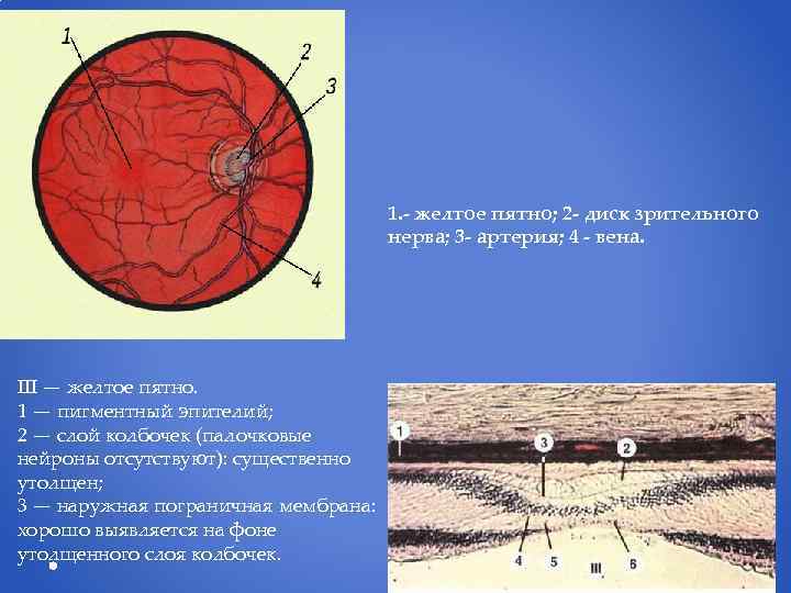 1. - желтое пятно; 2 - диск зрительного нерва; 3 - артерия; 4 -