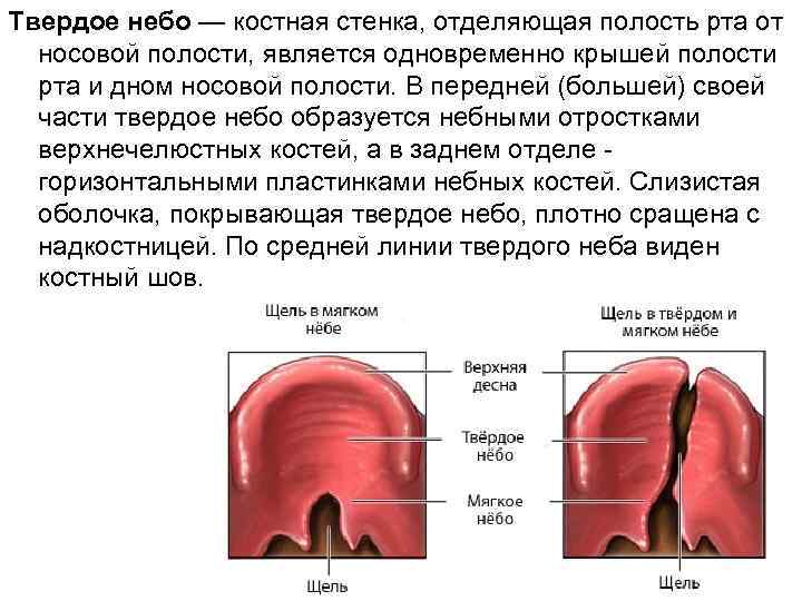 Костная стенка которая отделяет полость рта